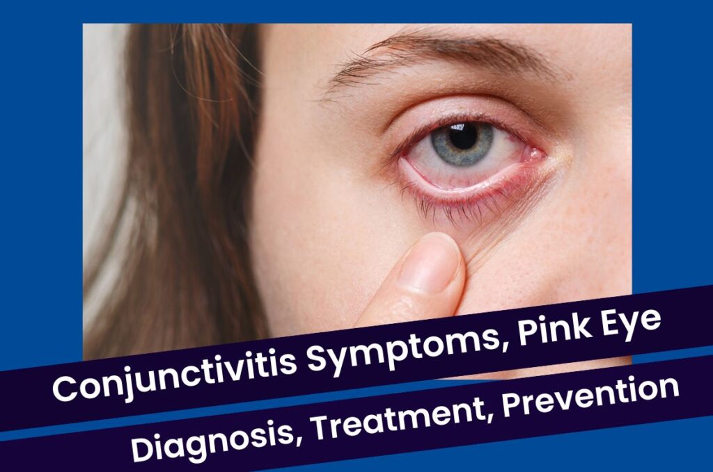 Conjunctivitis Symptoms, Pink Eye Diagnosis, Treatment, Medicine and Prevention
